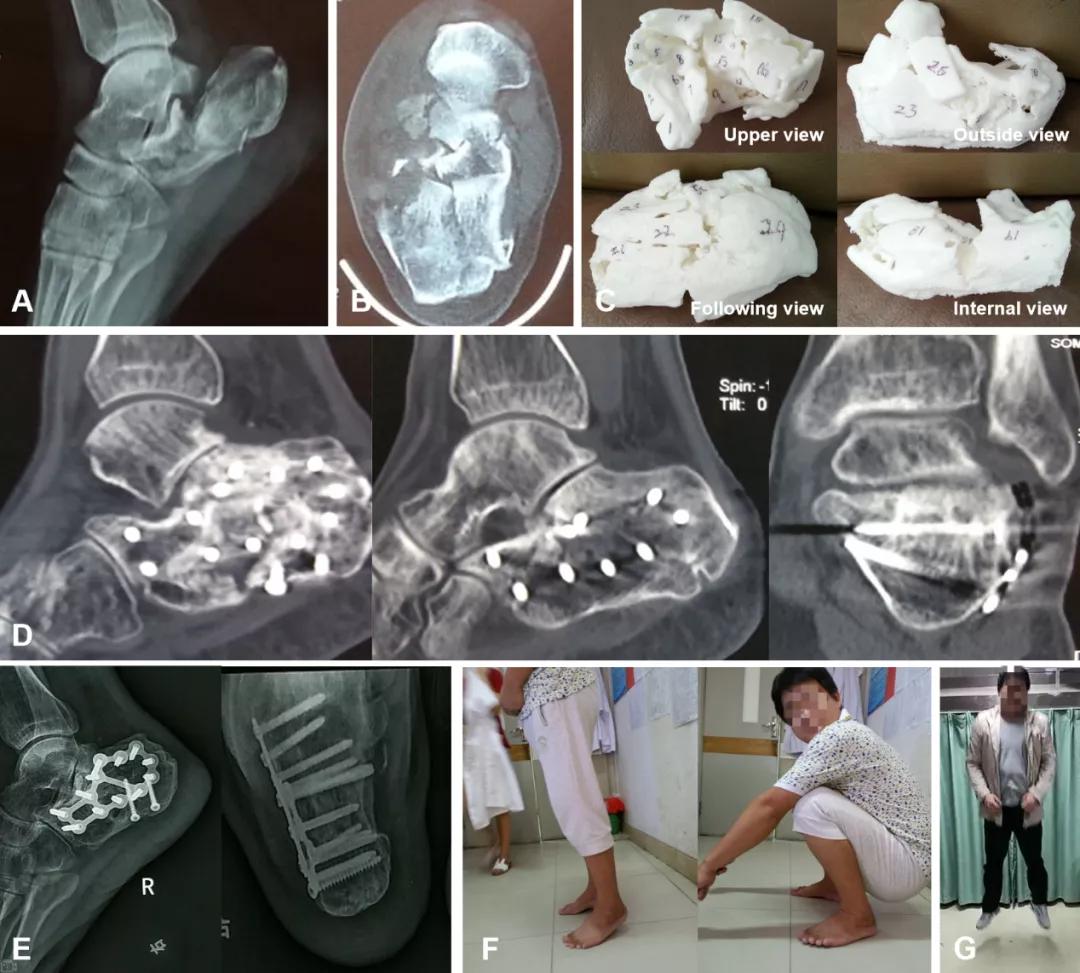3D数字顺序不对，真的能中奖吗？